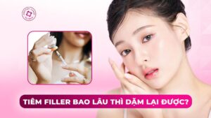 tiêm filler bao lâu thì dặm lại được