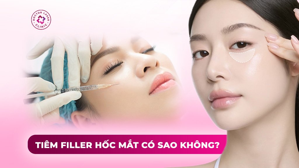 tiêm filler hốc mắt có sao không