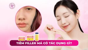 tiêm filler má có tác dụng gì