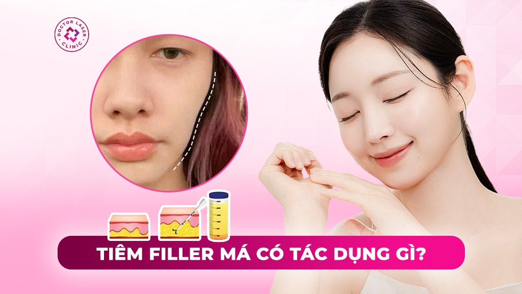 tiêm filler má có tác dụng gì
