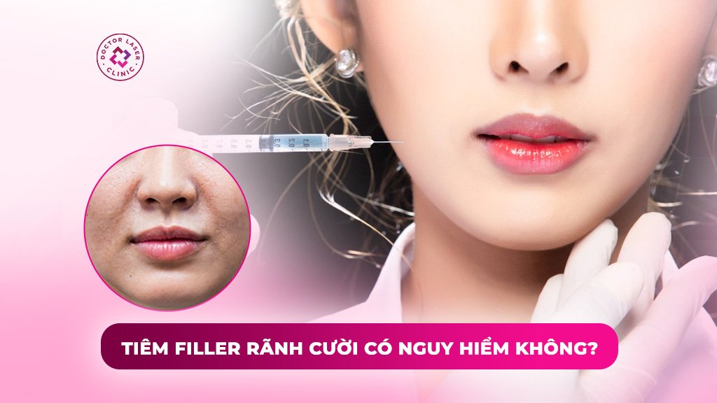 tiêm filler rãnh cười có nguy hiểm không