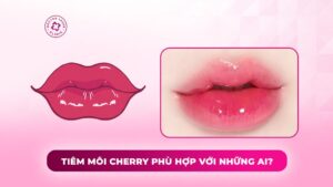 tiêm môi cherry phù hợp với những ai