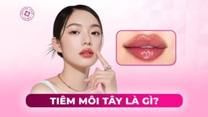 tiêm môi tây là gì tiêm môi tây là gì