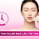 Tiêm tan filler bao lâu thì tan hết? Cần làm một hay nhiều lần?
