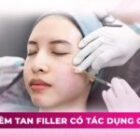 Tiêm tan filler là gì? Có an toàn không? Khi nào cần thực hiện?