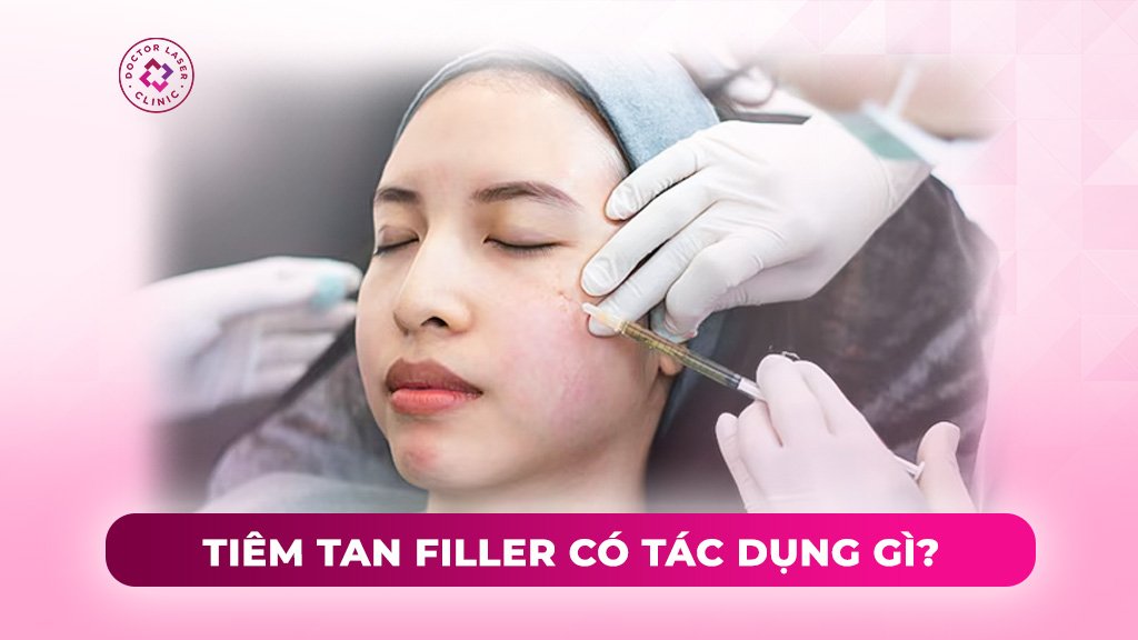 tiêm tan filler có tác dụng gì