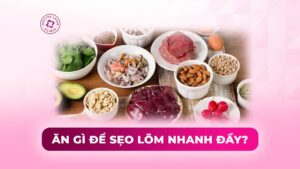 ăn gì để sẹo lõm nhanh đầy ăn gì để sẹo lõm nhanh đầy