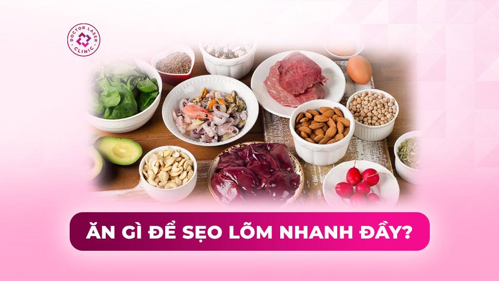 Ăn gì để sẹo lõm nhanh đầy? Một số lưu ý về chế độ dinh dưỡng
