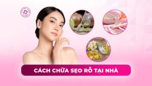 cách chữa sẹo rỗ tại nhà cách chữa sẹo rỗ tại nhà