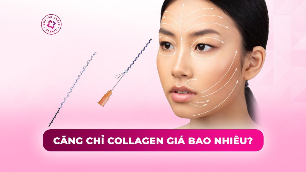 Căng chỉ collagen giá bao nhiêu? Bảng giá tham khảo chi tiết
