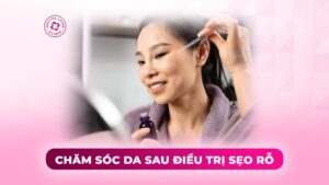 chăm sóc da sau điều trị sẹo rỗ