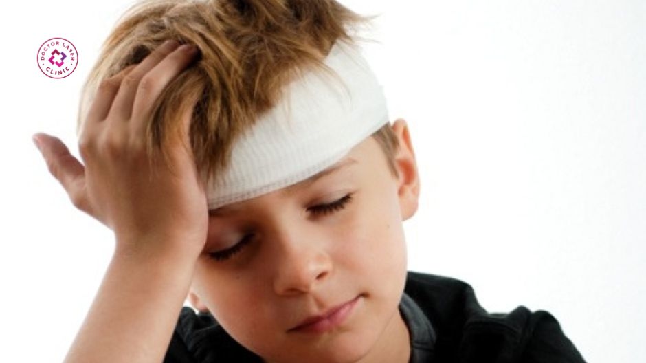 chấn thương vết thương ngoài da gây sẹo lõm vùng trán