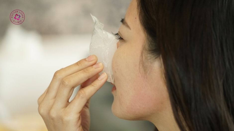 chườm đá giảm sưng sau tiêm filler