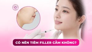 có nên tiêm filler cằm không