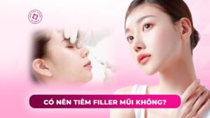 có nên tiêm filler mũi không có nên tiêm filler mũi không