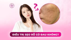 điều trị sẹo rỗ có đau không điều trị sẹo rỗ có đau không