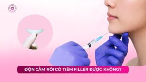 độn cằm rồi có tiêm filler được không