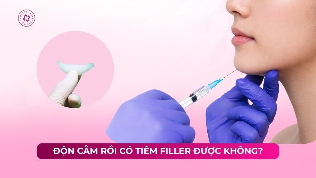 Độn cằm rồi có tiêm filler được không? Nên giãn cách bao lâu?