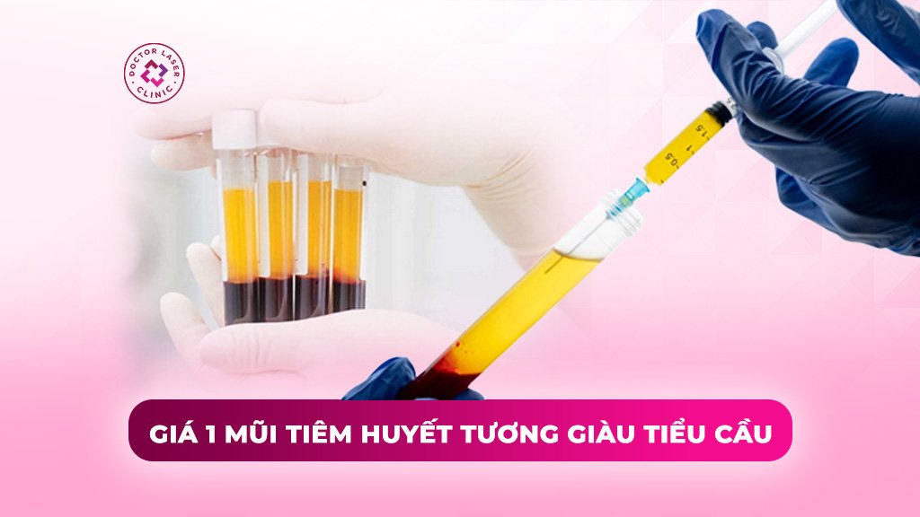 Giá 1 mũi tiêm huyết tương giàu tiểu cầu (PRP) bao nhiêu tiền?