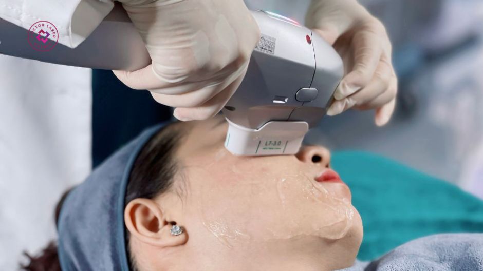 hifu trẻ hóa làn da