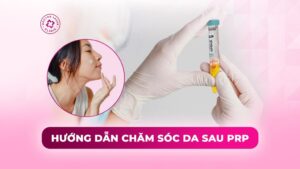 hướng dẫn chăm sóc da sau prp hướng dẫn chăm sóc da sau prp