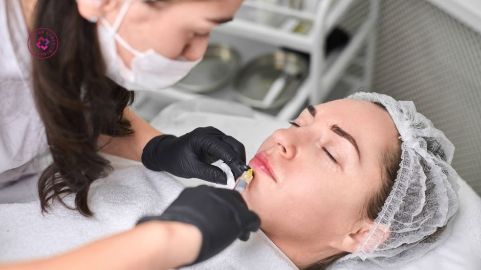 hướng dẫn kiêng nước sau tiêm filler