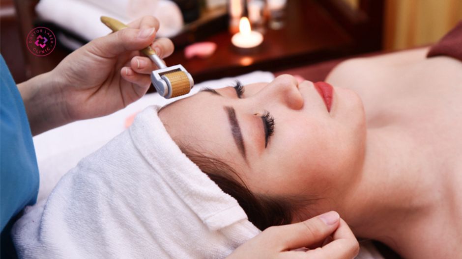 lăn kim microneedling hỗ trợ tái tạo da và cải thiện sẹo rỗ