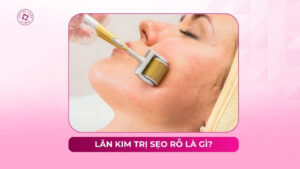 lăn kim trị sẹo rỗ là gì lăn kim trị sẹo rỗ là gì