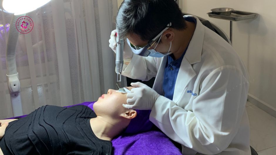 điều trị sẹo rỗ lâu năm bằng laser co2 fractional