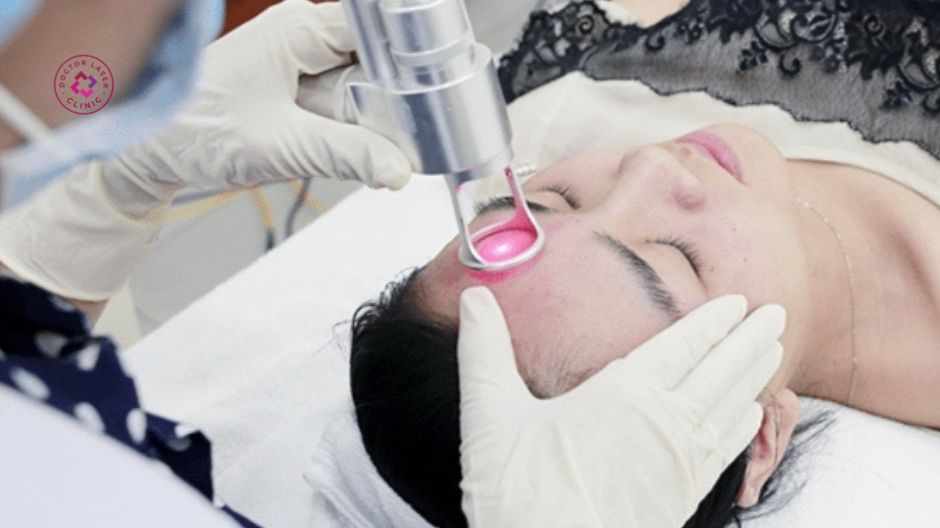 laser-co2-fractional-xam-lan-tri-seo-lom