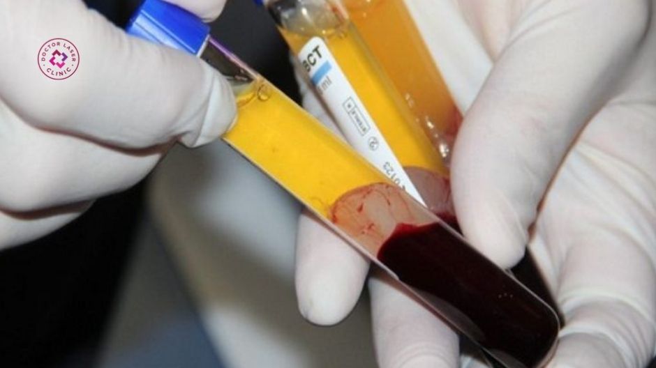 ly tâm máu tách huyết tương giàu tiểu cầu prp