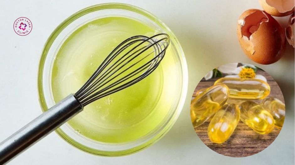 mặt nạ vitamin e và lòng trắng trứng cho da sẹo rỗ