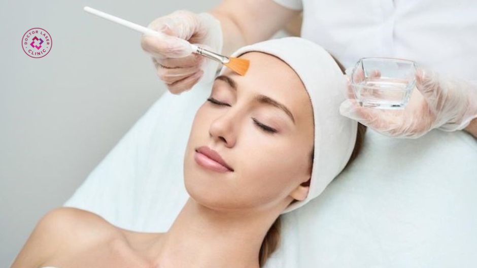 peel da hóa học kết hợp vitamin e hỗ trợ sẹo rỗ