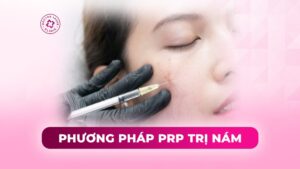 phương pháp prp trị nám phương pháp prp trị nám