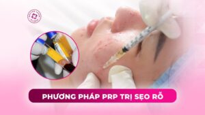 phương pháp prp trị sẹo rỗ phương pháp prp trị sẹo rỗ