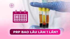 prp bao lâu làm 1 lần prp bao lâu làm 1 lần