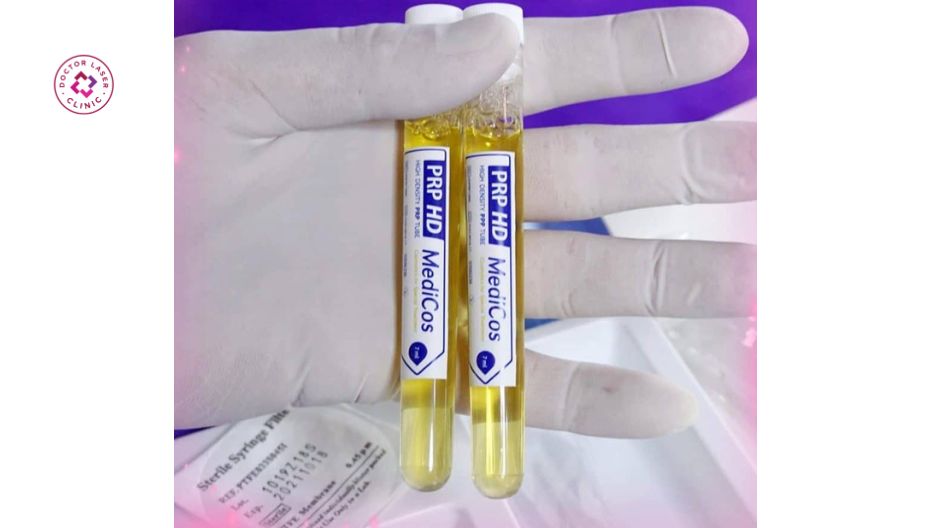 prp huyết tương giàu tiểu cầu hỗ trợ điều trị sẹo rỗ