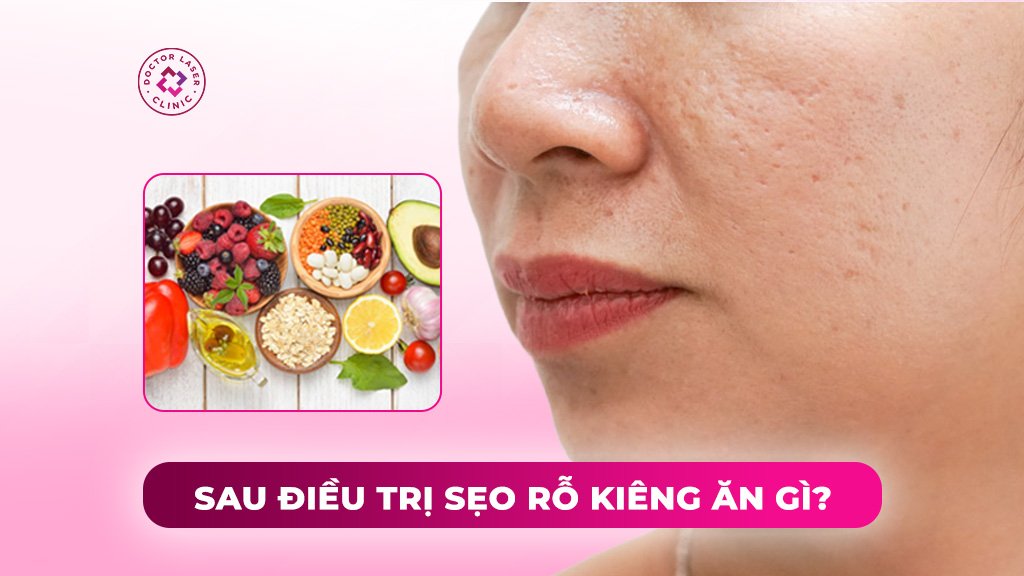 Sau điều trị sẹo rỗ kiêng ăn gì để da nhanh phục hồi?
