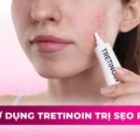 Sử dụng Tretinoin trị sẹo rỗ thế nào cho hiệu quả?