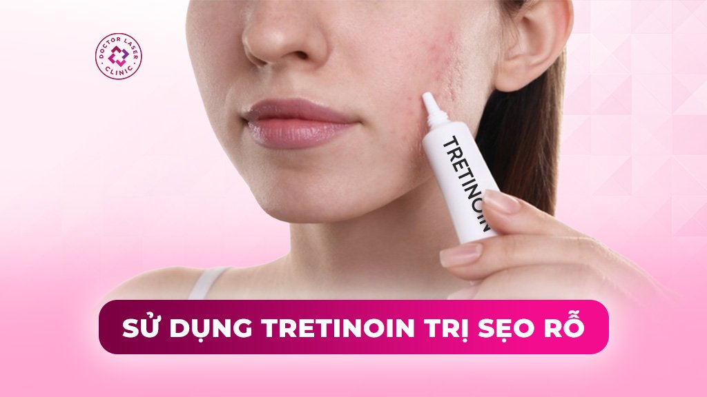 sử dụng tretinoin trị sẹo rỗ