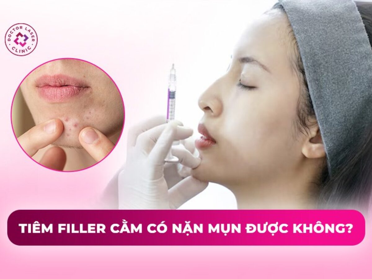 TIÊM FILLER CẰM GIÁ BAO NHIÊU