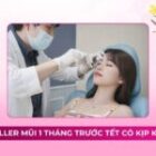 Tiêm filler mũi 1 tháng trước tết có kịp không?