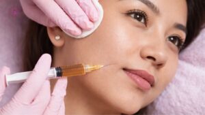 tiêm filler nhiều năm liền có làm gương mặt bị phồng, biến dạng về sau không