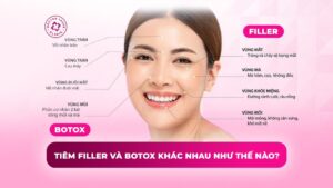 tiêm filler và botox khác nhau như thế nào