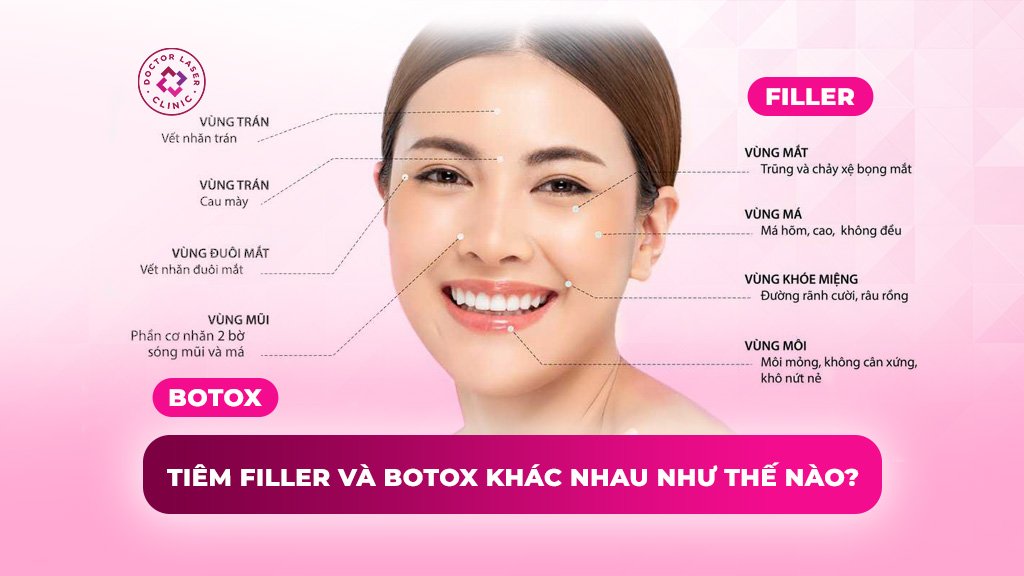 tiêm filler và botox khác nhau như thế nào