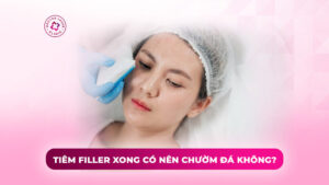 tiêm filler xong có nên chườm đá không