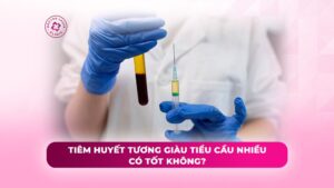 tiêm huyết tương giàu tiểu cầu nhiều có tốt không tiêm huyết tương giàu tiểu cầu nhiều có tốt không