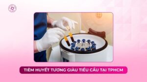 tiêm huyết tương giàu tiểu cầu tại tphcm tiêm huyết tương giàu tiểu cầu tại tphcm