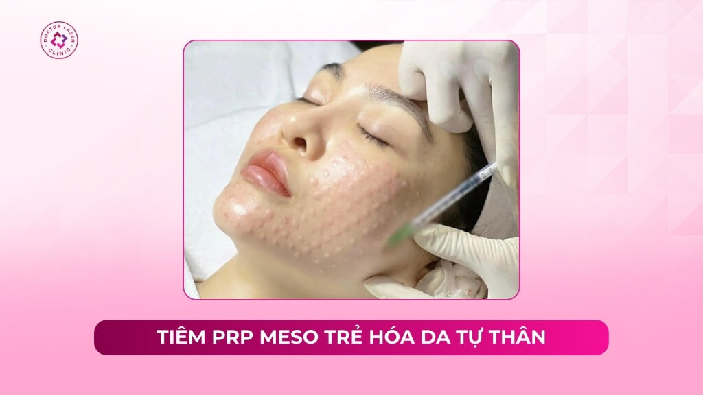 Giải pháp tiêm PRP Meso giúp trẻ hóa da và lấp đầy sẹo rỗ