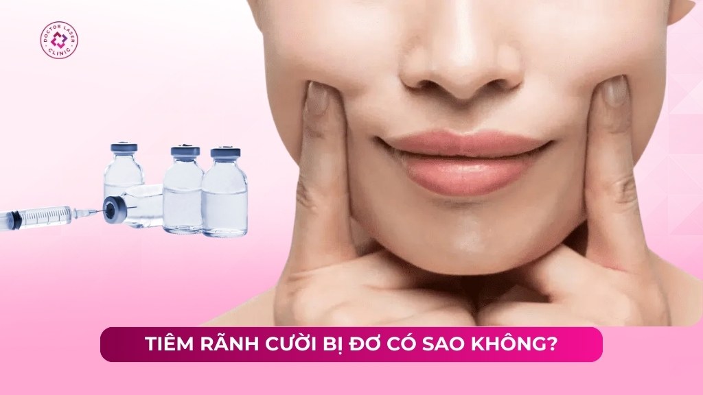 tiêm rãnh cười bị đơ có sao không